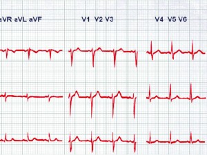 Figure 1: Case study: ECG presentation to a general practitioner 