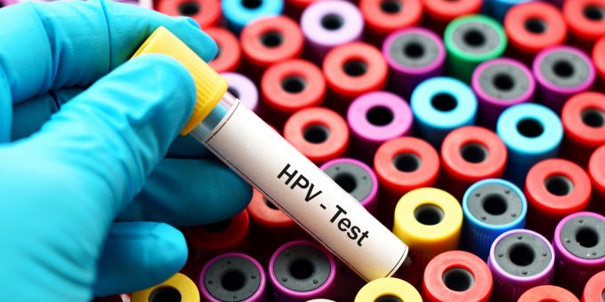 Hpv Test For Women Over 65 : Cervical cancer in women over 65: An ...