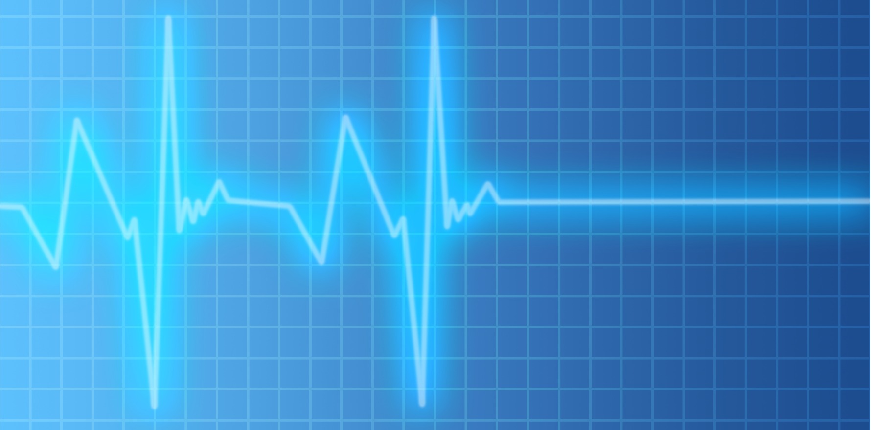 Confusion and anger over quiet ECG changes • The Medical Republic