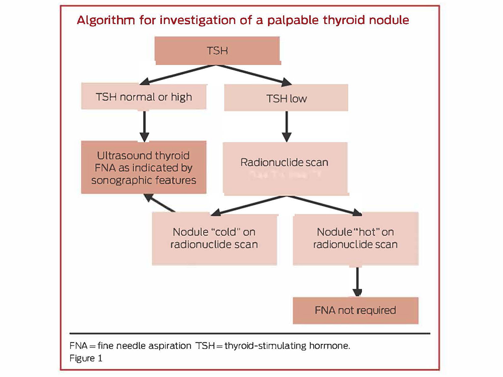 Thyroid Nodules When To Investigate Medical Republic