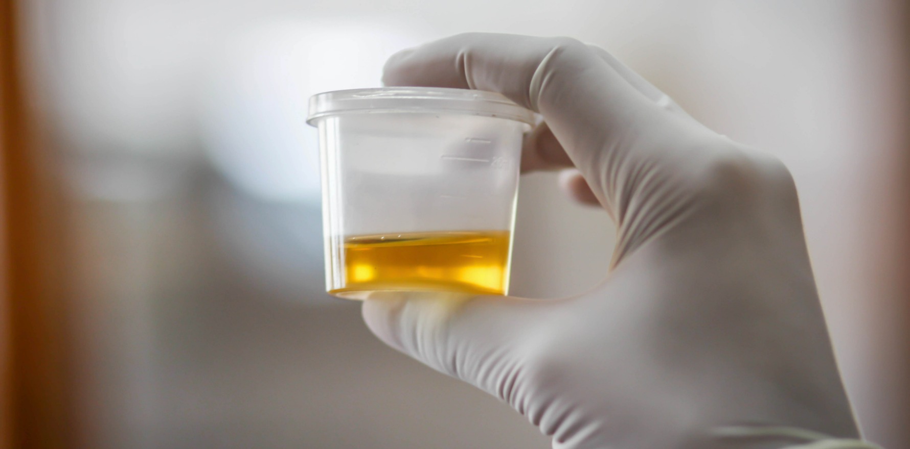 Guild eyes more states for UTI trial • The Medical Republic